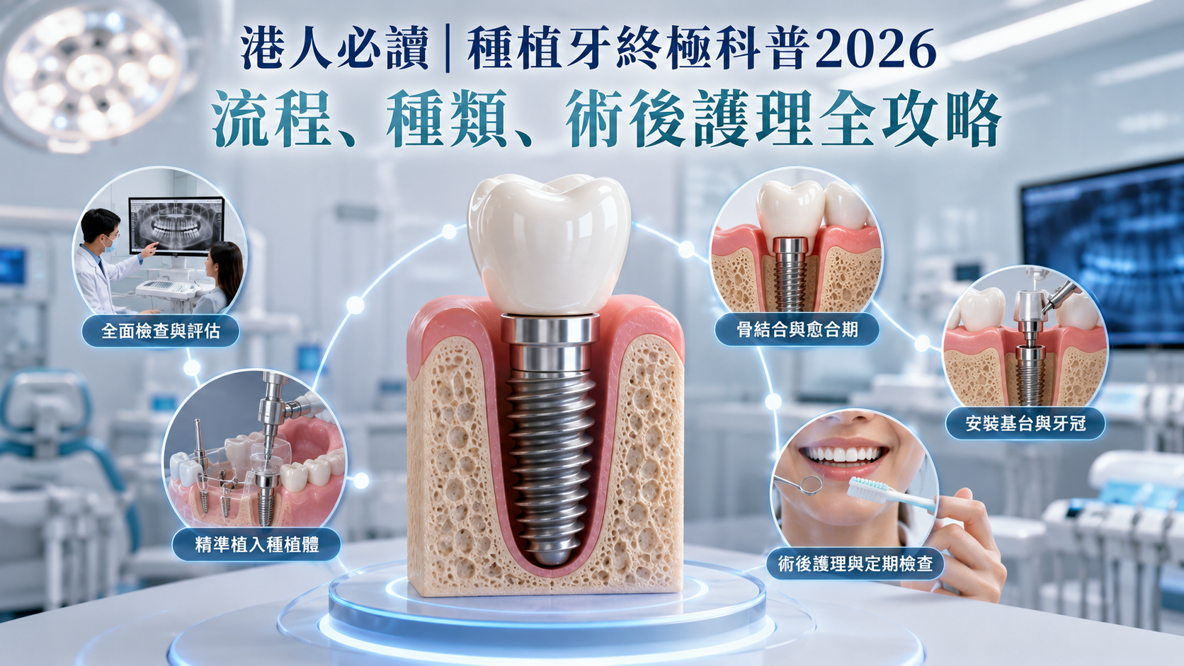 港人必讀｜種植牙終極科普2026｜流程、種類、術後護理全攻略