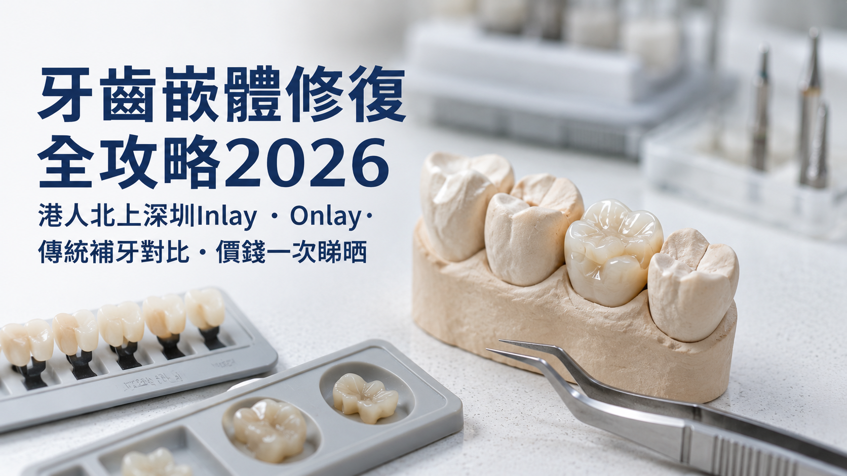 牙齒嵌體修復全攻略2026｜港人北上深圳Inlay・Onlay・傳統補牙對比・價錢一次睇晒