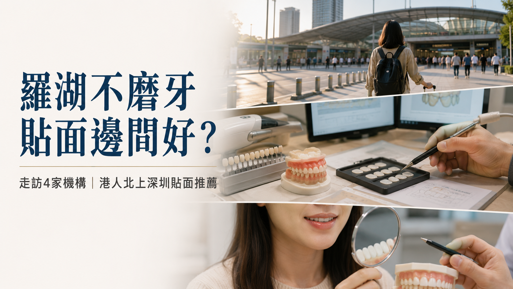 羅湖不磨牙貼面邊間好？